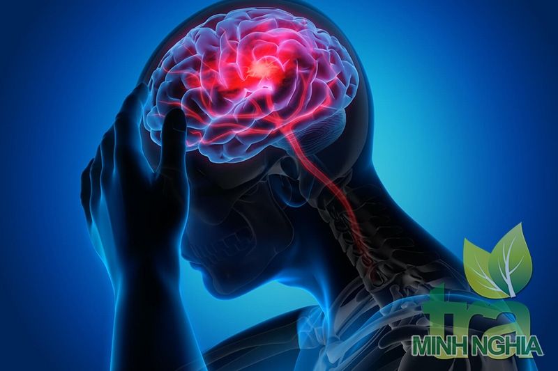 Bài thuốc dân gian chữa nhức đầu do cảm phong