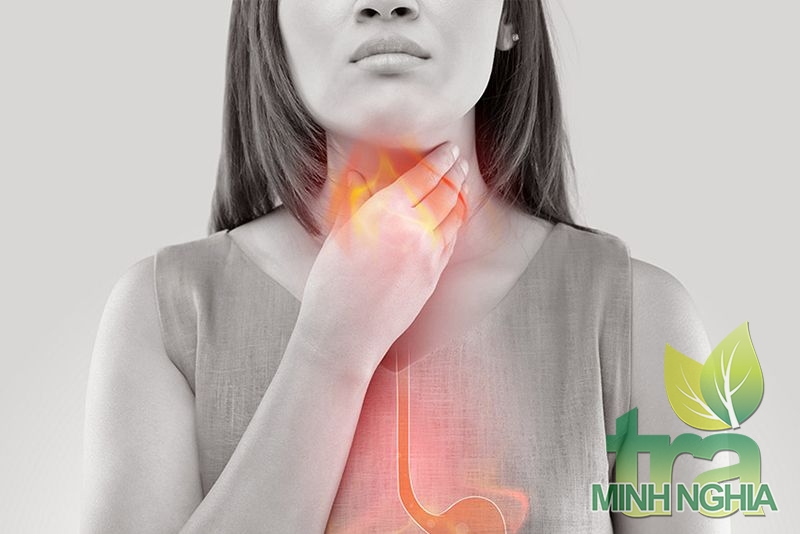 Chữa trào ngược dạ dày nên dùng loại trà nào để hiệu quả?